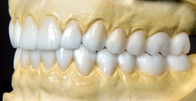 Восковая модель зубов