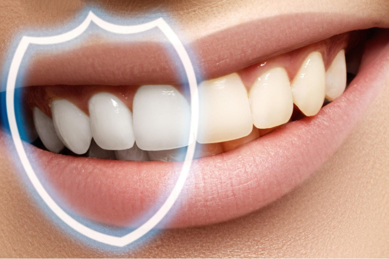 Состояние зубов после реминерализации