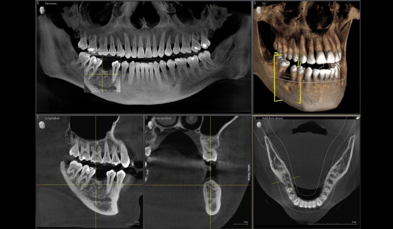 На этапе диагностики перед ортодонтическим лечением