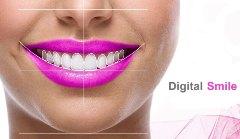 Цифровой дизайн улыбки при планировании ортодонтического лечения