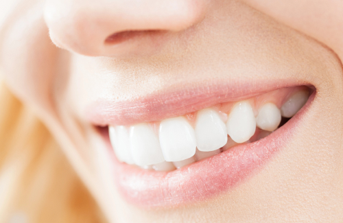 Отзывы о самых популярных продуктах и процедурах отбеливания зубов