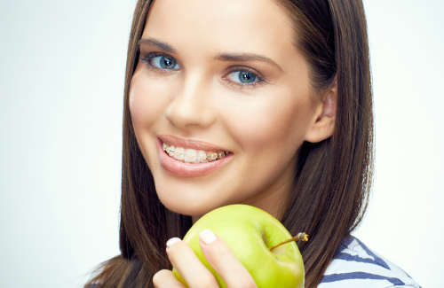 Каких продуктов следует избегать людям с ортодонтическими брекет-системами?