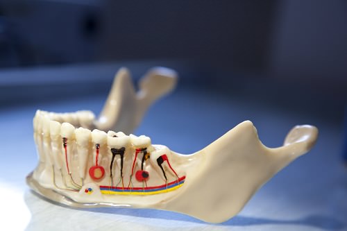 Процедура удаления нерва зуба в современной стоматологии