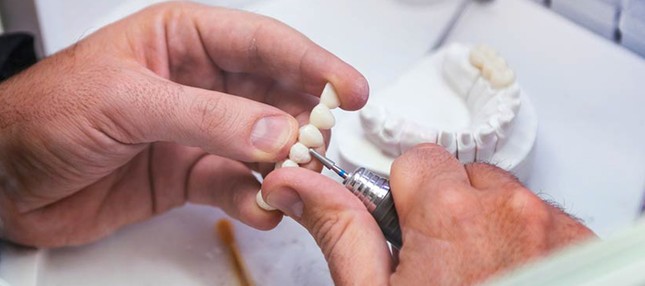 В процессе изготовки протеза в зуботехнической лаборатории