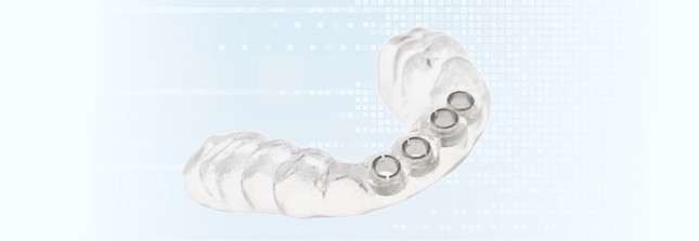 Пример хирургического шаблона для имплантации с опорой на зубы