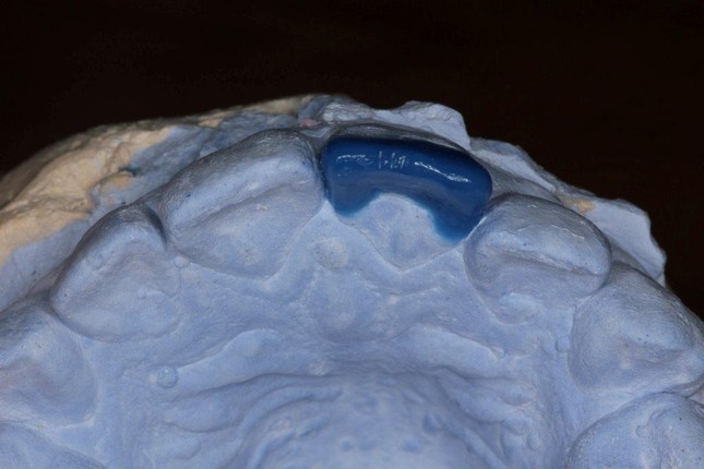 Моделировочный слепок зубов