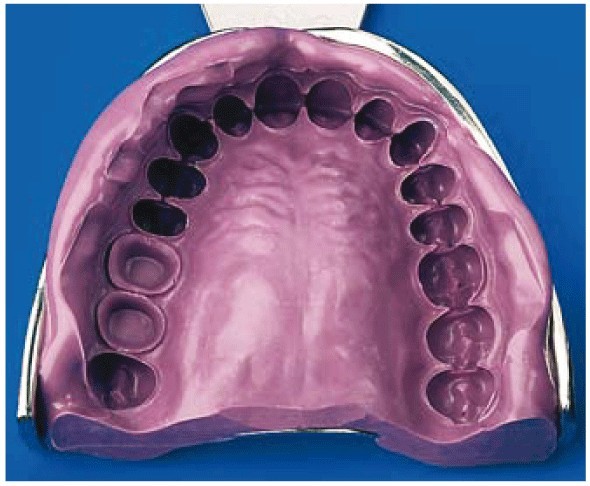 Слепок зубов из эластичных материалов
