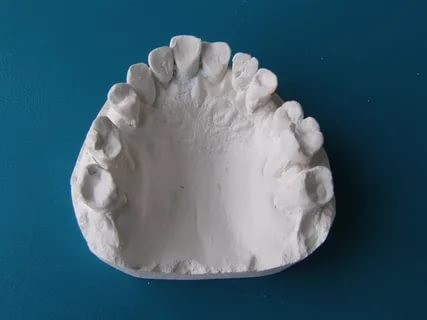 Слепок зубов из твердых материалов