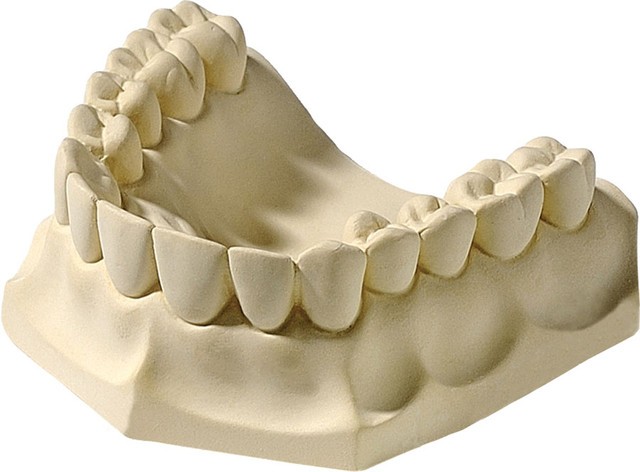 Гипсовая модель челюсти