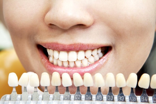 Подбор оттенка искусственных зубов