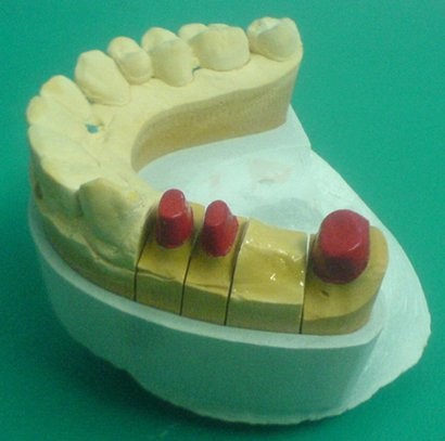 Модель челюсти