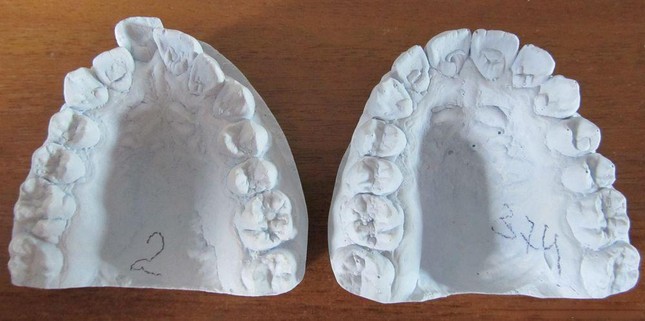 Шаблоны зубов