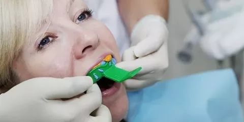 Снятие слепков зубов
