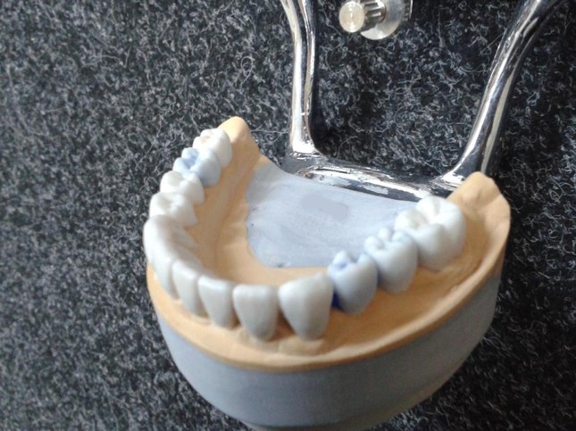 Моделирование зубов из воска