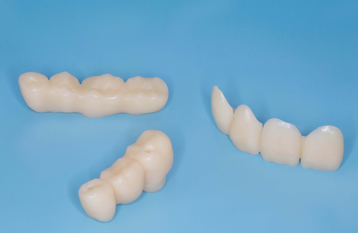 Пластмассовые коронки на зубы — особенности и этапы установки