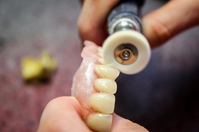 На этапе изготовления зубных протезов