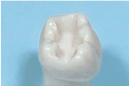 Препарированный зуб