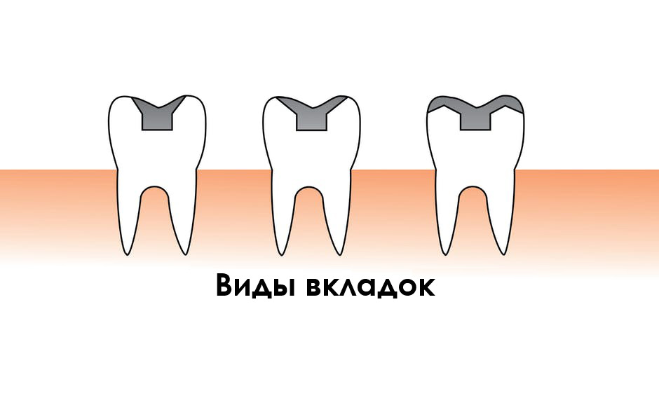 Аномалии размеров и формы зубов