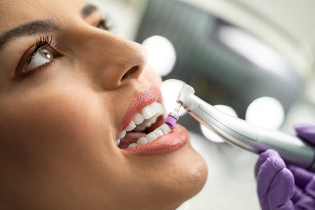 Профессиональная чистка зубов ВСЕГО за 3̶7̶0̶0̶ 3000 ₽ при записи с сайта